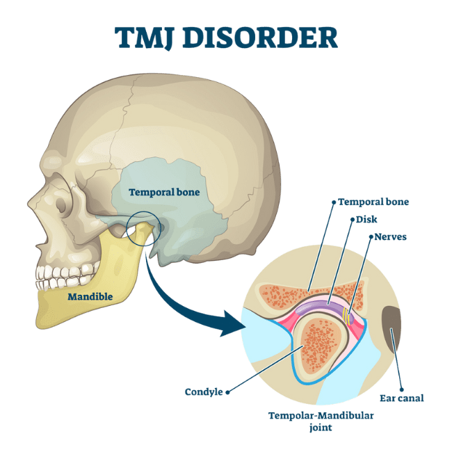 Chiropractic Solutions for TMJ Relieving Jaw Pain and Improving Function, Sea One Family Chiropractic Myrtle Beach SC